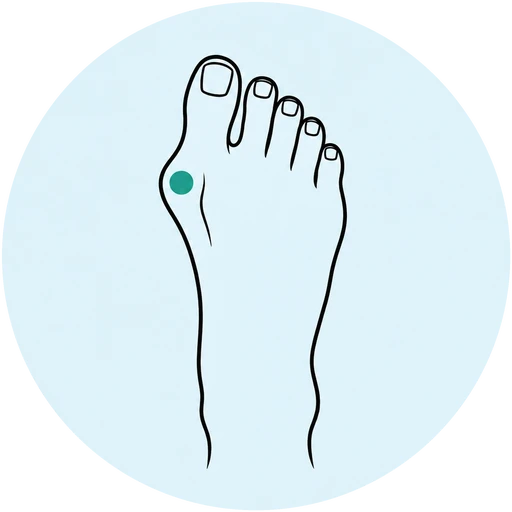 Foot illustration highlighting the big toe joint
